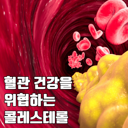 콜레스테롤 혈관 건강 위협