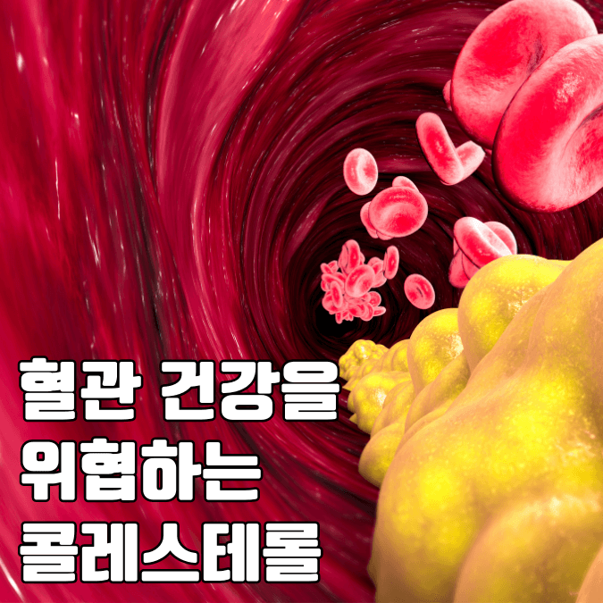 LDL콜레스테롤이 혈관에 미치는 위협