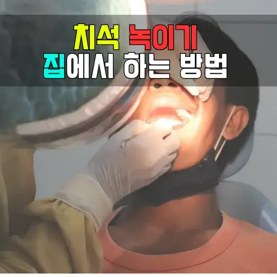 치석 녹이기 집에서 하는 방법