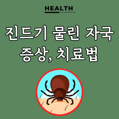 진드기 물린 자국 보고 찾아 보는 증상, 치료 및 예방 방법