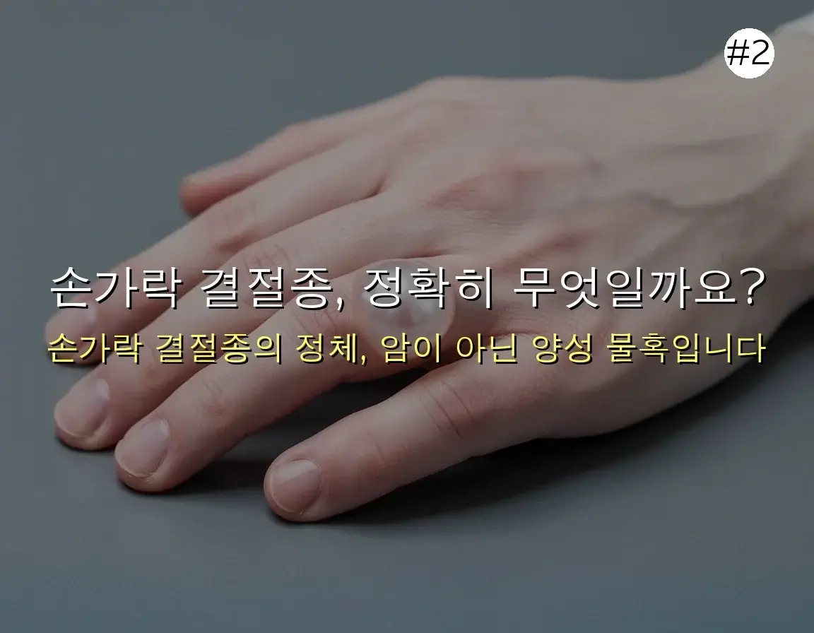 손가락 마디 결절종 초보자를 위한 팁 관련 이미지: 손가락 결절종, 정확히 무엇일까요?